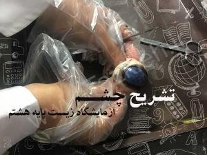 تشریح چشم